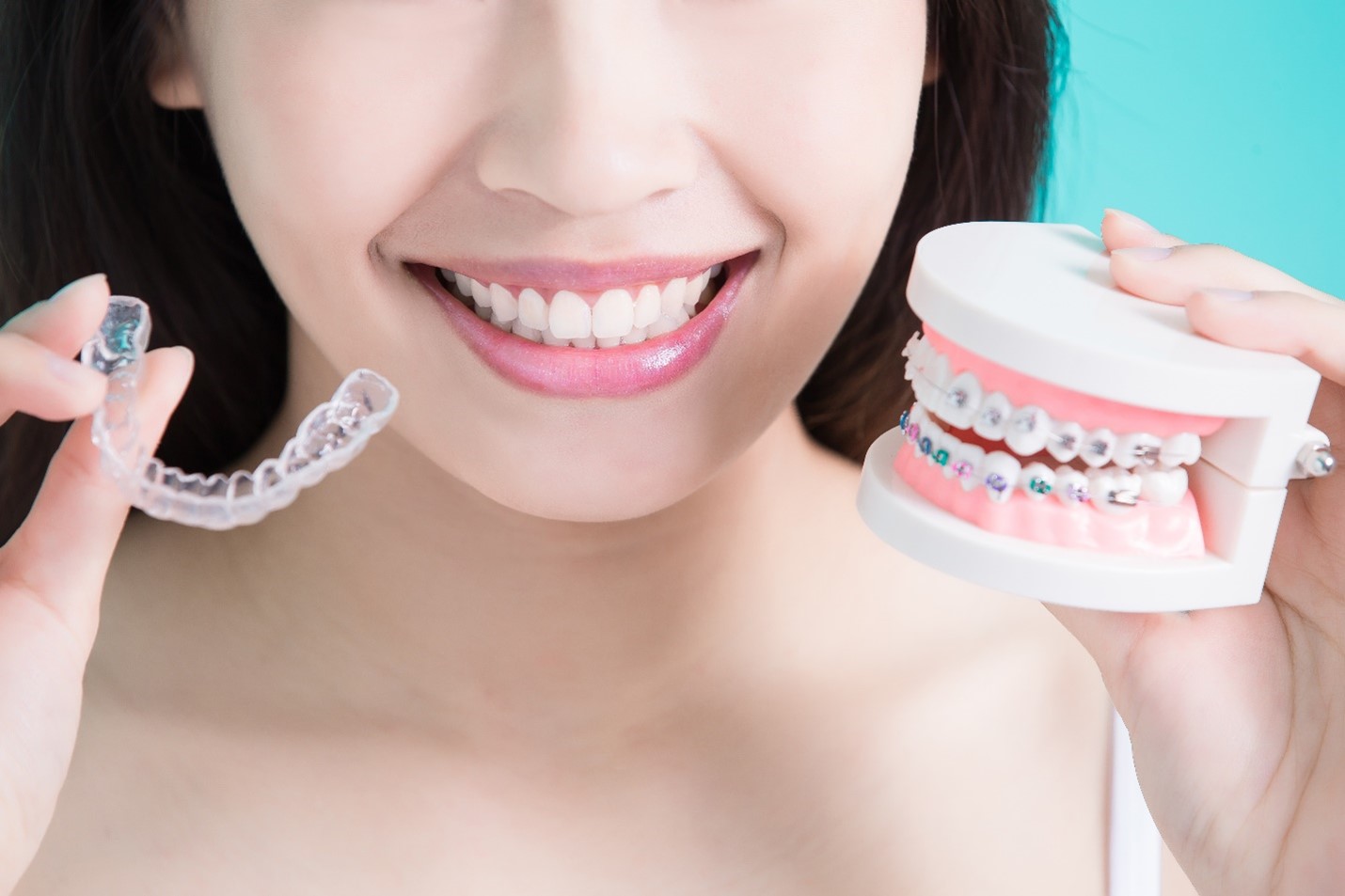 Can You Get Invisalign After Braces?